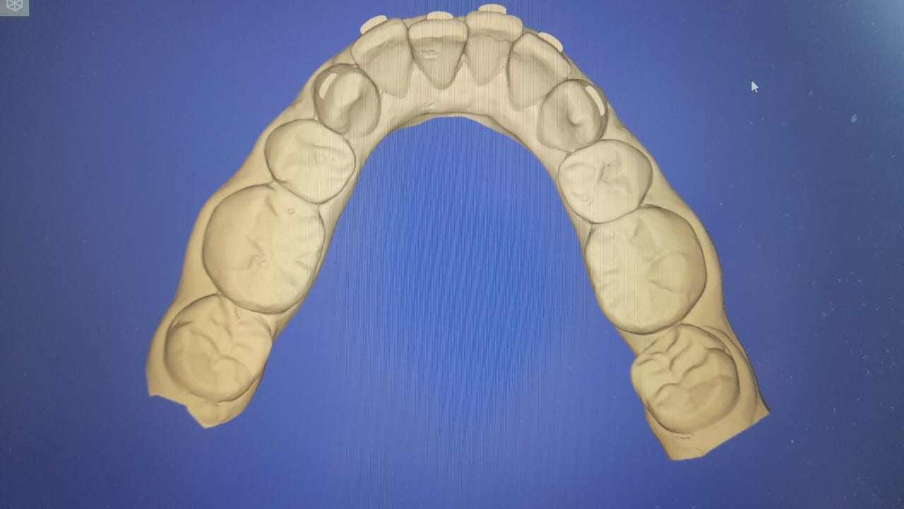 Cône Beam / CBCT