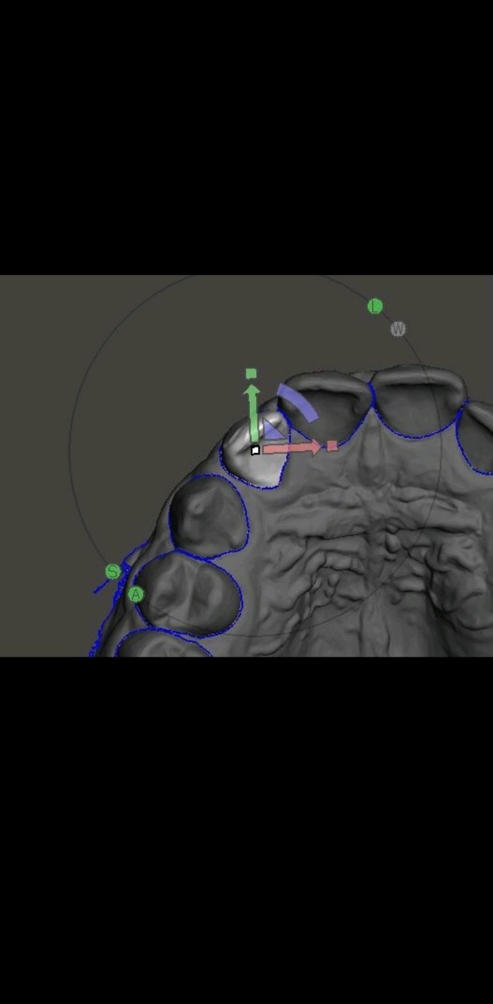 CBCT Scanner